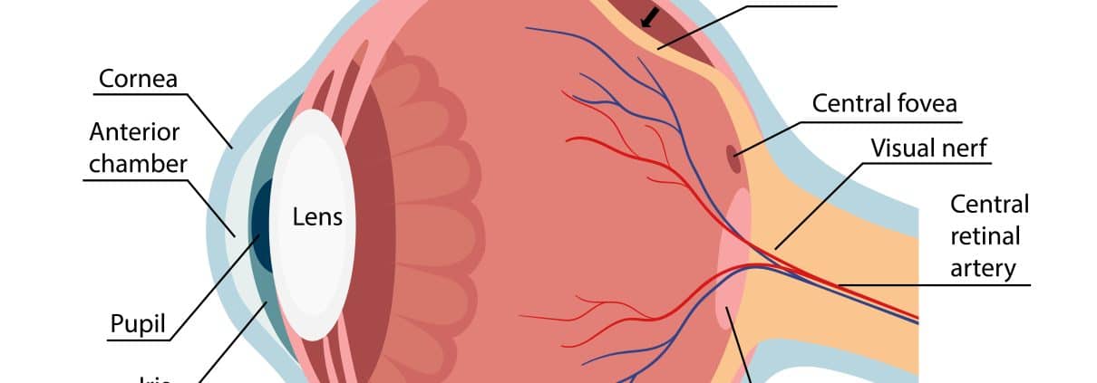 What Causes Retinal Detachment?